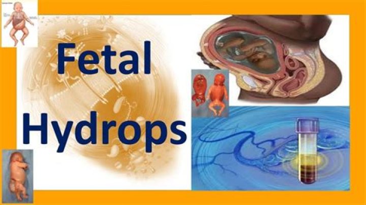 Are hydros bad for baby?