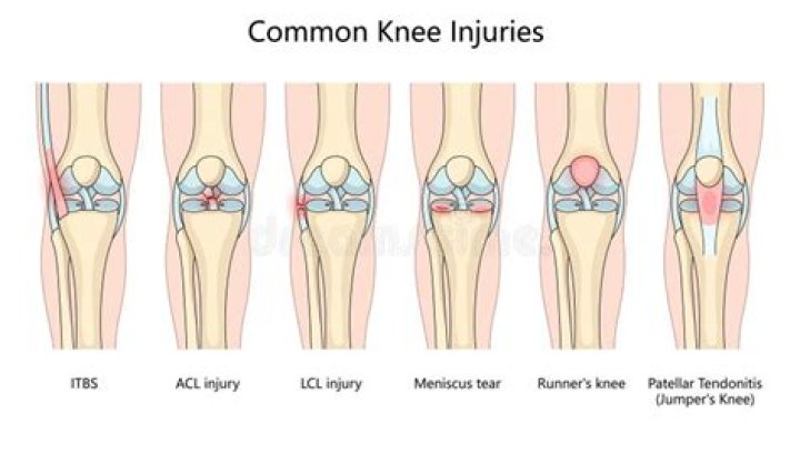 Are knee injuries common?