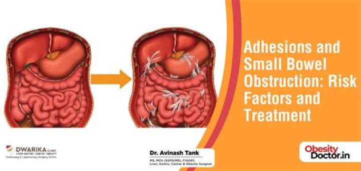 Can adhesions cause bowel obstruction?