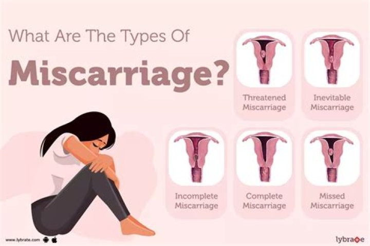 Can gardasil cause miscarriage?