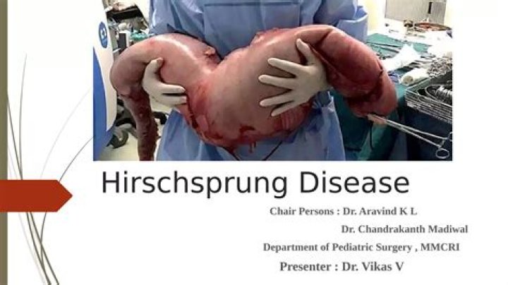 Can hirschsprung's disease be cured?