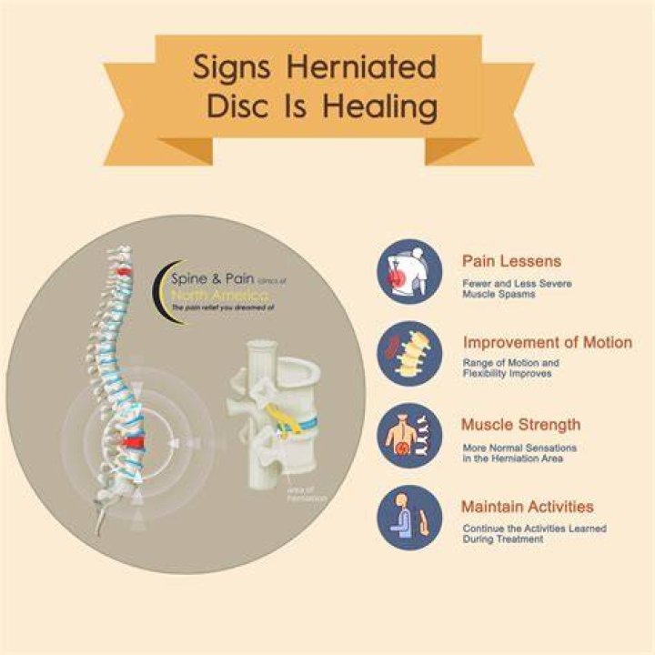 Can you feel a herniated disc?