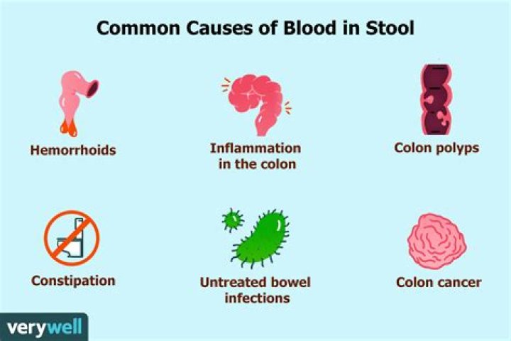 Could blood in stool be from hemorrhoids?
