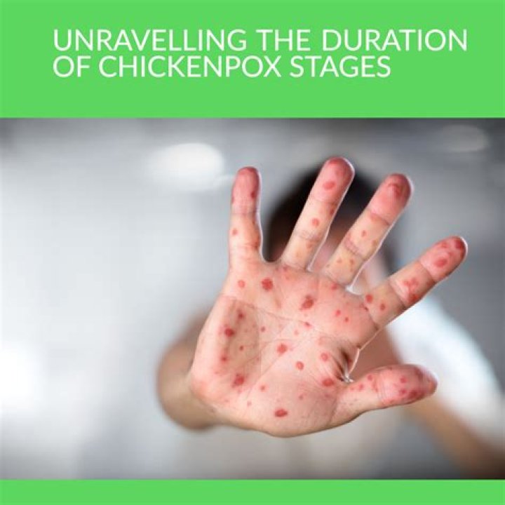 Do chickenpox come from chickens?