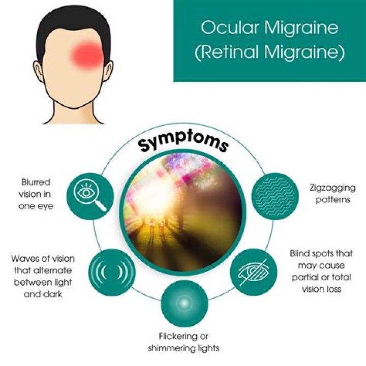 Do migraines impair vision?