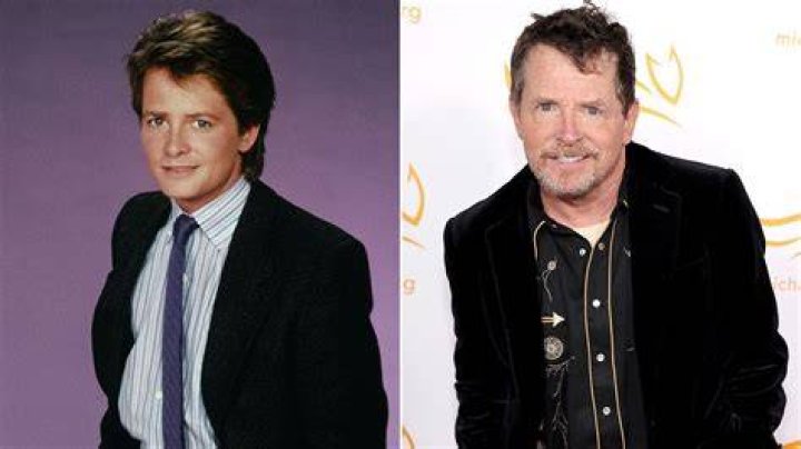 Does michael j fox have parkinson's?