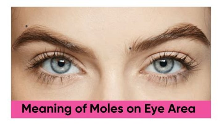 Does moles have eyes?