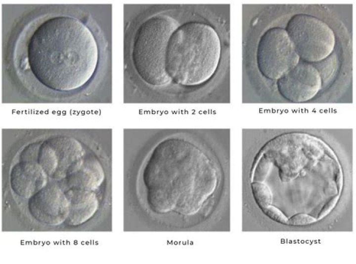 Has an embryo been fertilized?
