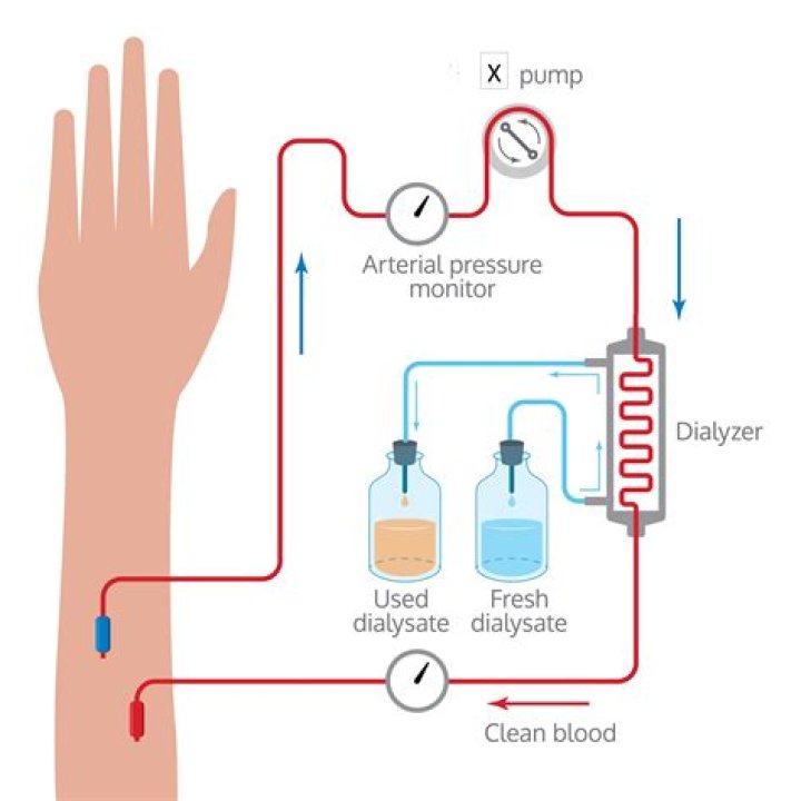 How bloodless dialysis machine works?