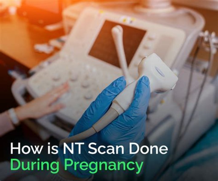 How nt scan is done?