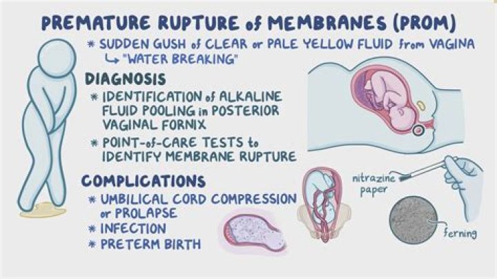 In prolonged rupture of membranes?