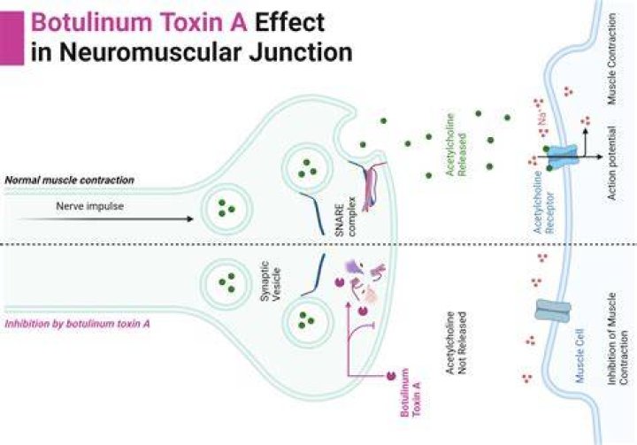 Is botulinum toxin an endotoxin?