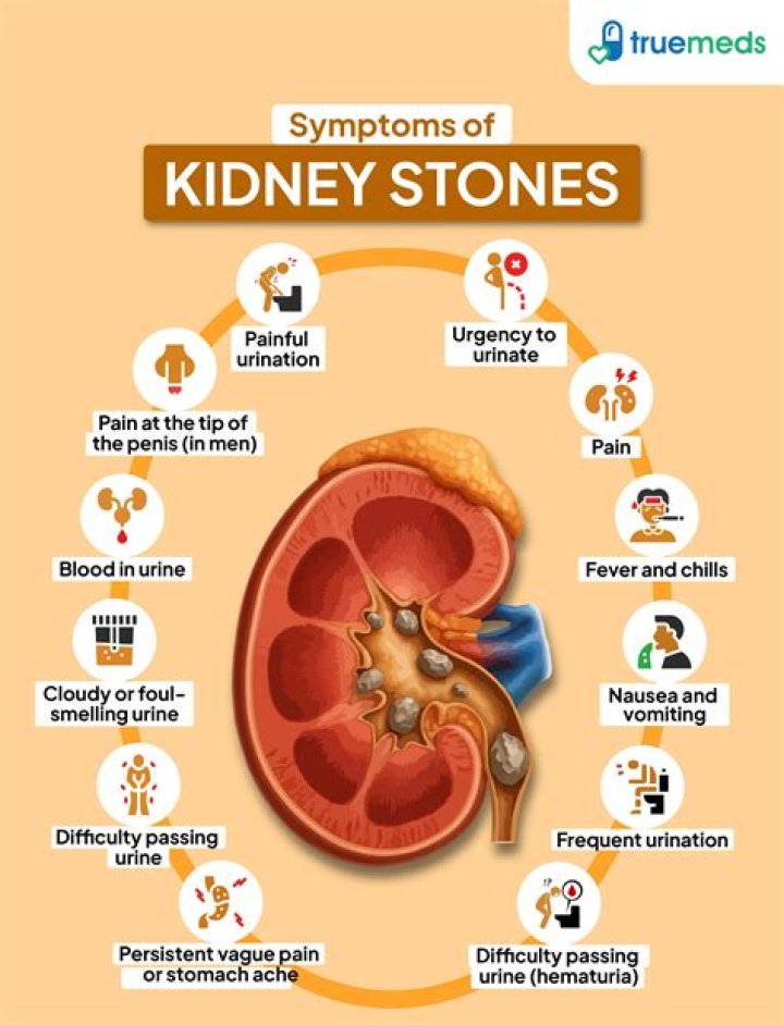 Is kidney stone a disease?
