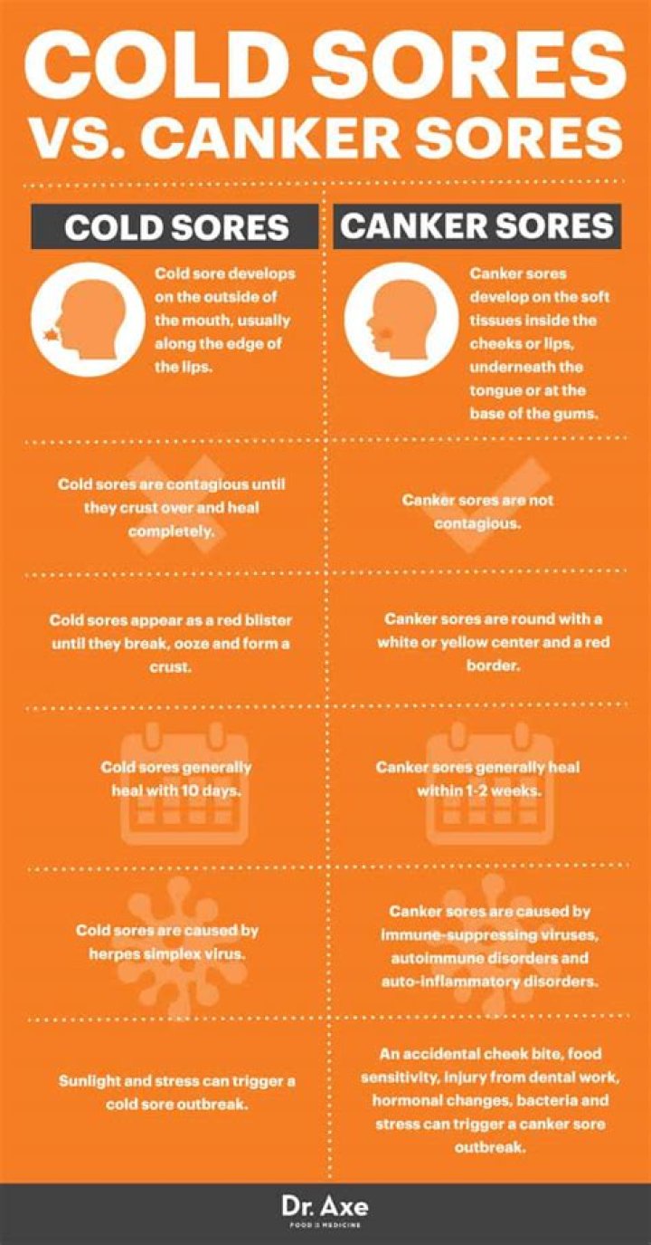 Should you pop cold sores?
