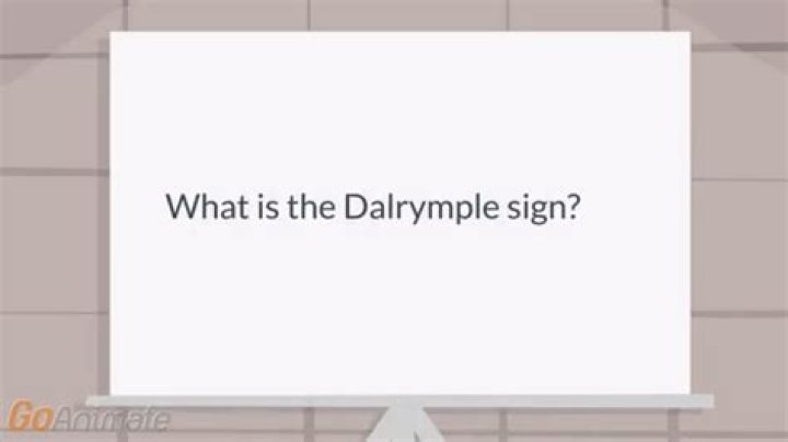 What does dalrymple mean?