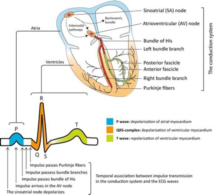 What does electrophysiological changes mean?