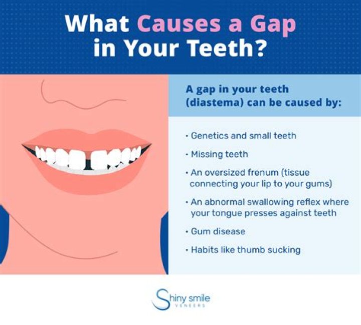 What does gap in your teeth mean?