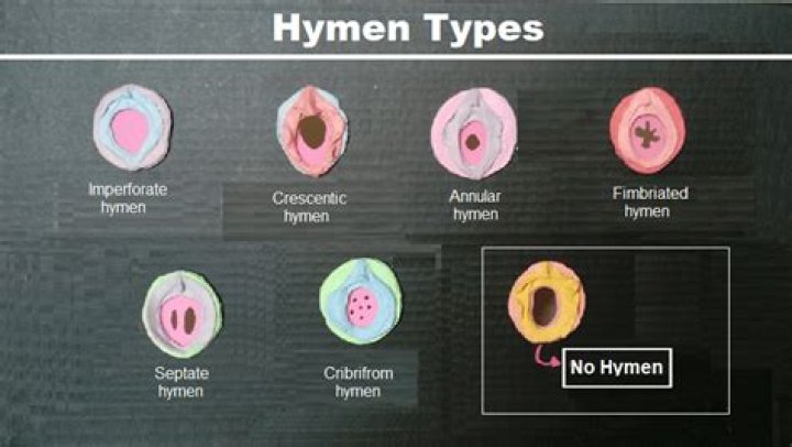 What does hymenotomy mean?
