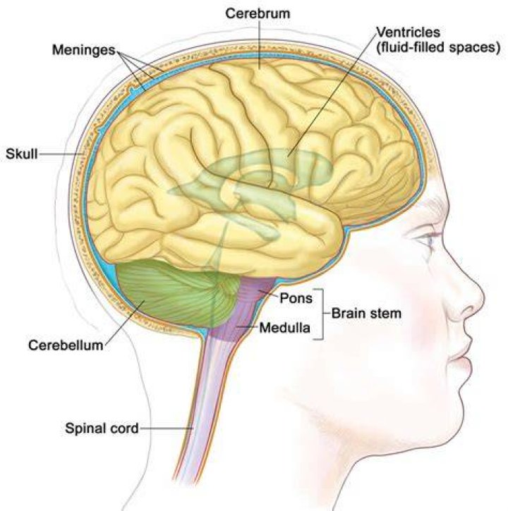 What does meningitis do to the brain?