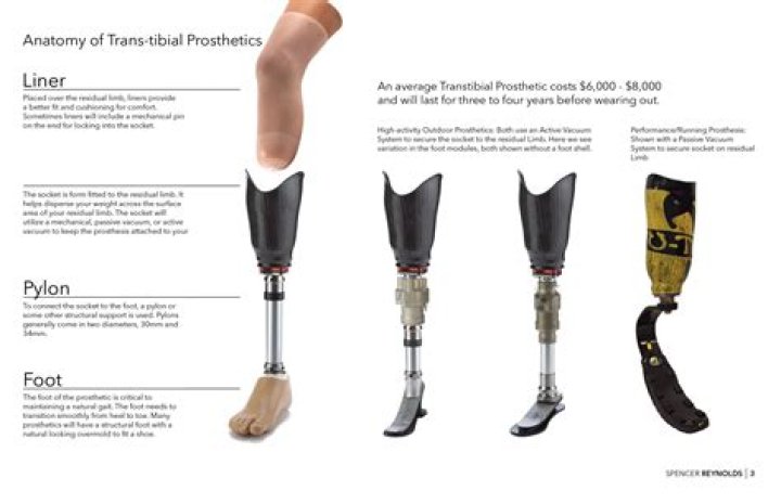 What does prosthesis mean?