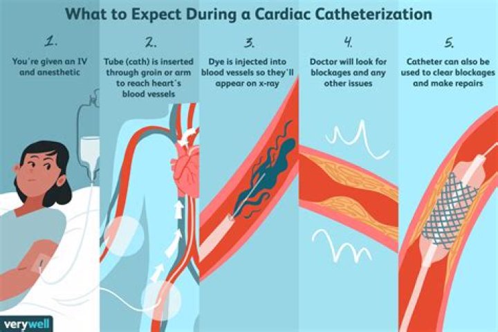 Whats a cardiac cath?