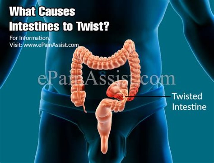Whats a twisted intestine?