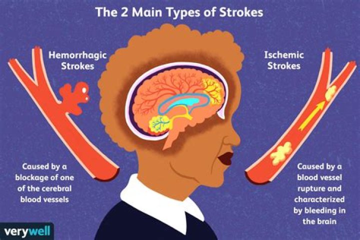Whats long stroke mean?