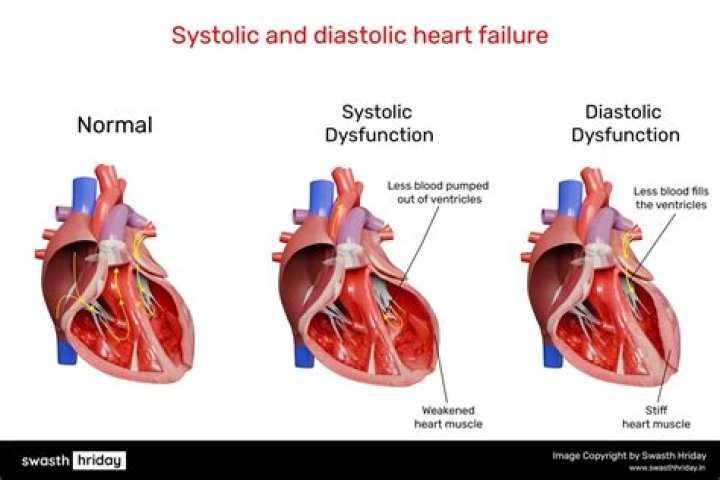 Whats worse high systolic or diastolic?