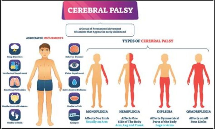 When does cerebral palsy occur?