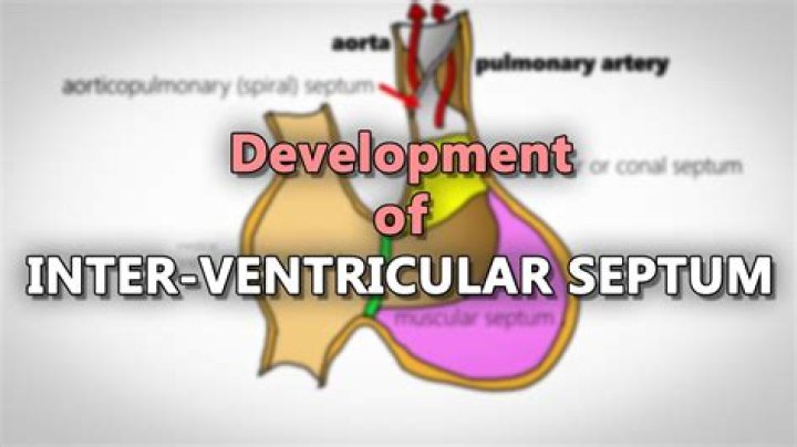 When does the interventricular septum contract?