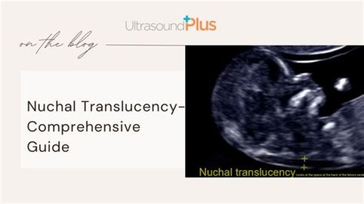 When nuchal translucency test?