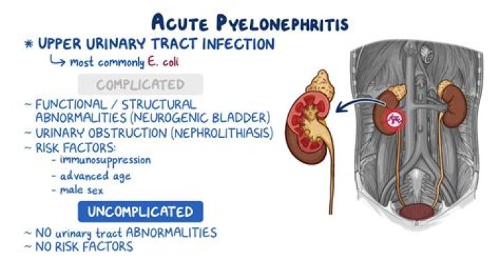 Where can pyelonephritis be found?