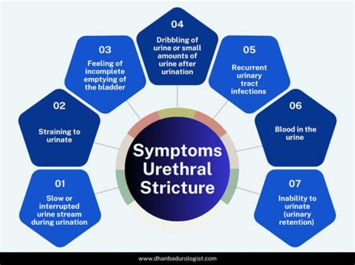 Where does urethral stricture hurt?