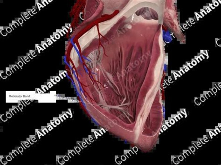 Where is septomarginal trabecula located?
