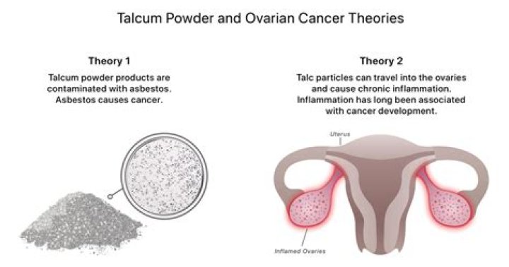 Where is talcum located?