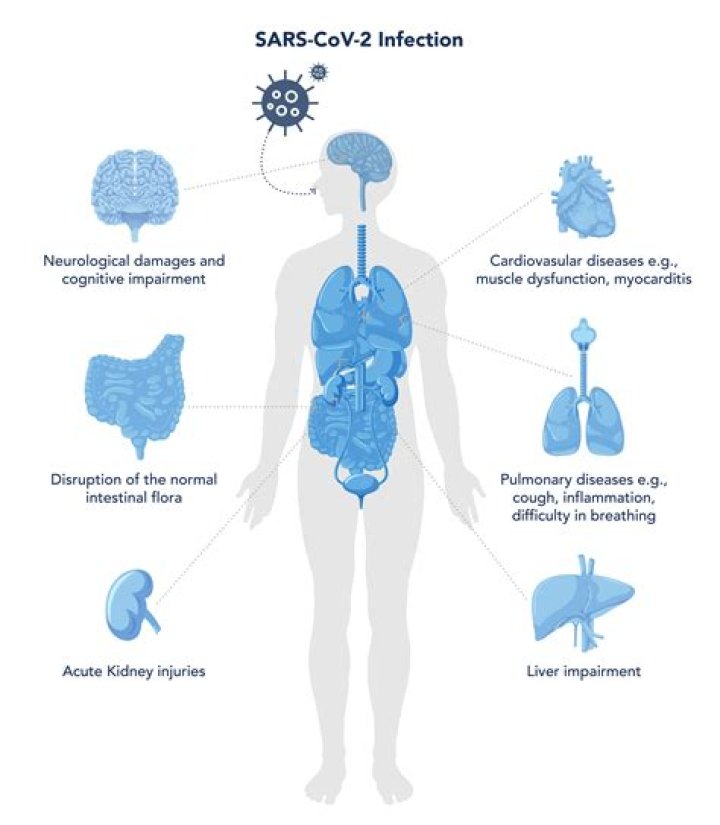 Who has been most affected by covid?
