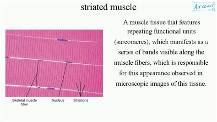 Why are skeletal muscles striated?