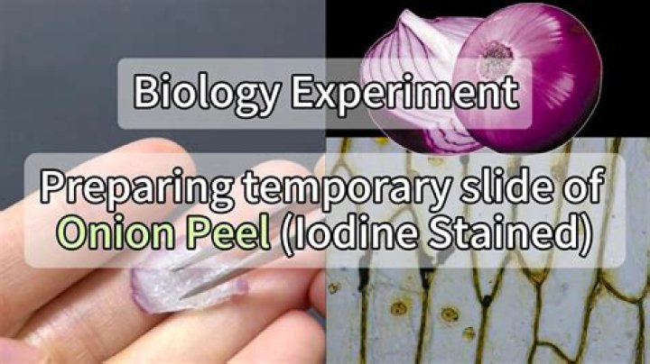 Why iodine used to stain the onion peel?
