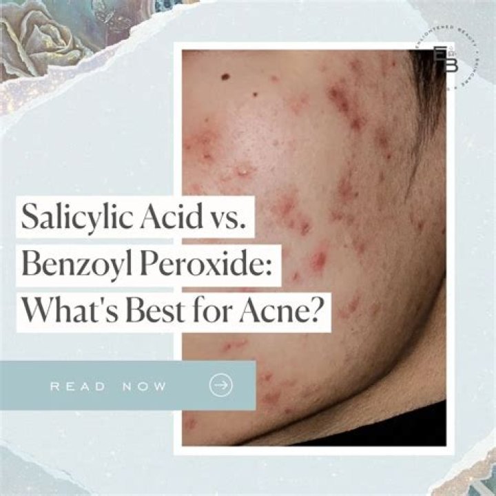 Why peroxide is bad for wounds?