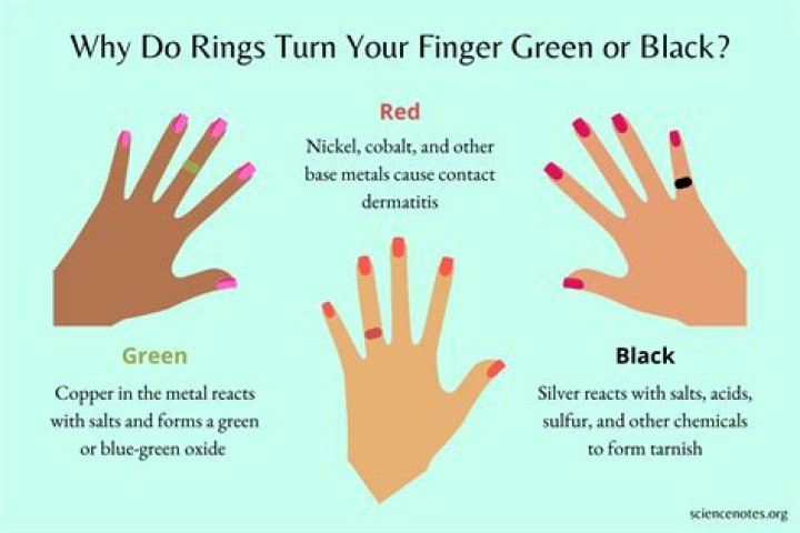 Why rings make your finger green?