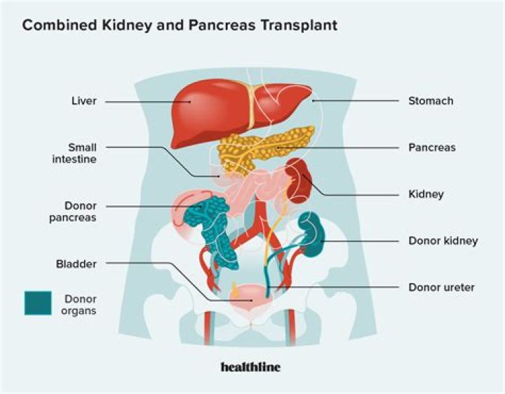 Why transplanted kidney is placed in the lower abdomen?