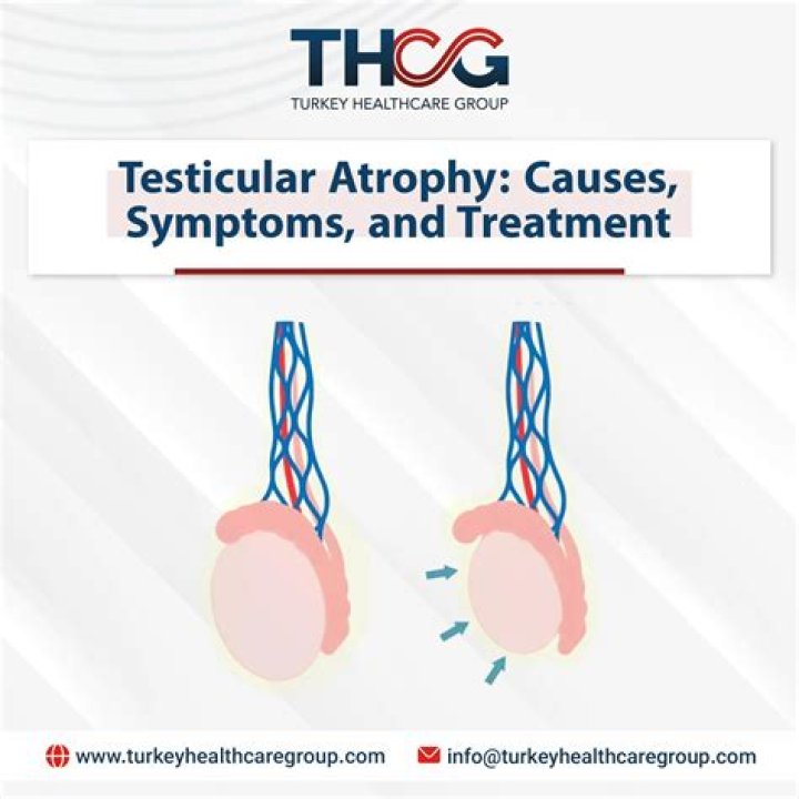 Will clomid help testicular atrophy?