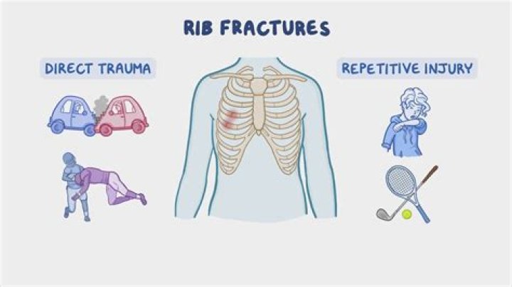 Would you be able to walk with a broken rib?